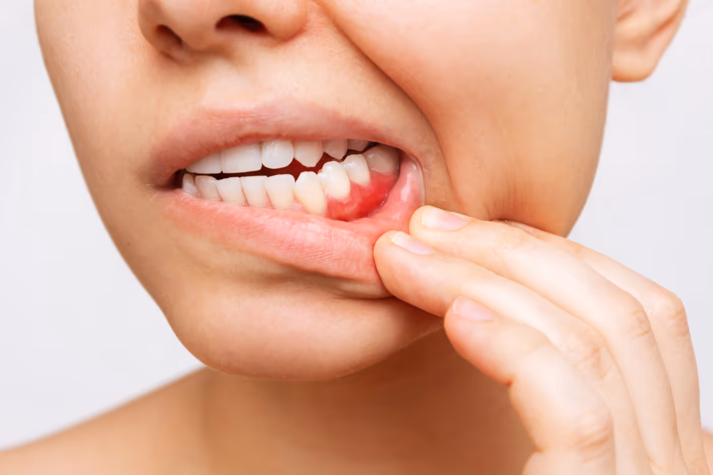 Understanding Gum Disease: Why Periodontal Care Matters